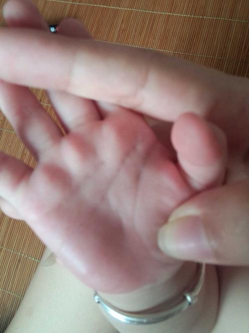 宝宝的掌纹很奇怪,宝妈们谁知道怎么回事?