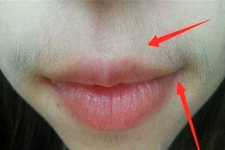 女人长胡子什么原因5种暗示说明身体出问题警惕2