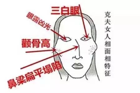 克夫?我太阳穴凹陷被人说面相不好!我该怎么办?