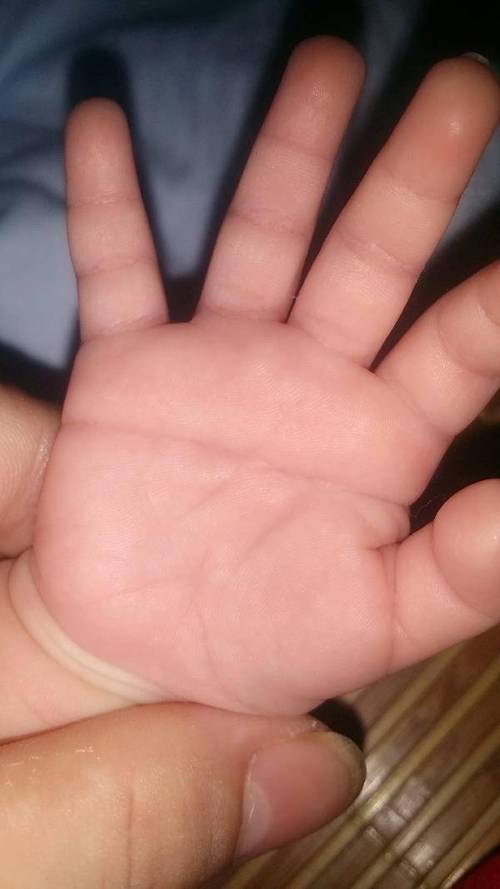 原创小宝宝手掌有横纹代表智力有问题来看看关于掌纹的秘密