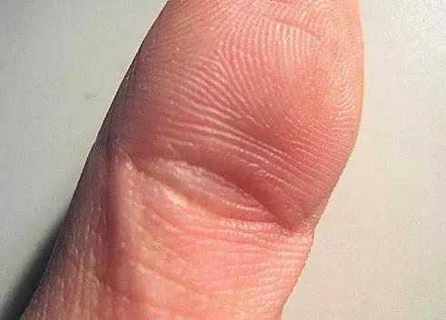 4.大拇指第一节纹只有一条线