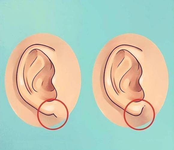 耳朵不同命不同?自测看看,你是哪种耳型?_耳垂_面相_生活