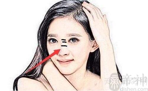女人鼻梁有横纹面相看运势,注意出行和健康
