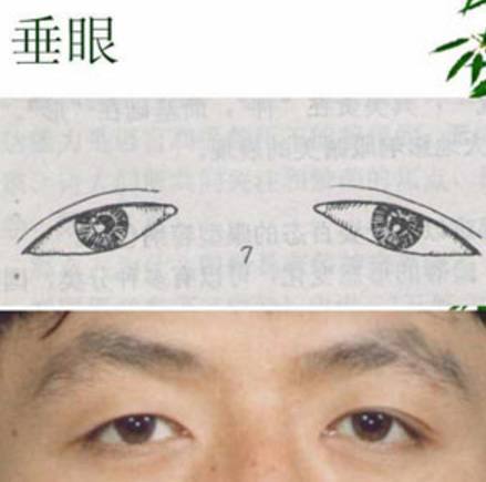 外形特征与吊眼相反,外眦角低于内眦角,眼轴线向下倾斜形成了外眼角下