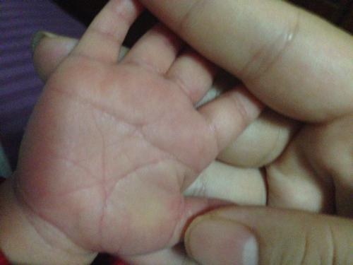 这个掌纹啥意思?有点特别,出生11天小婴儿的手