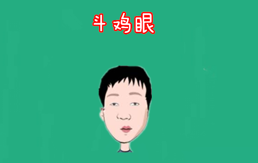 斗鸡眼