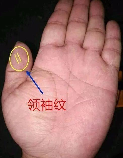大拇指的第一指节上端有两条平行的斜纹,手相中称作领袖纹.
