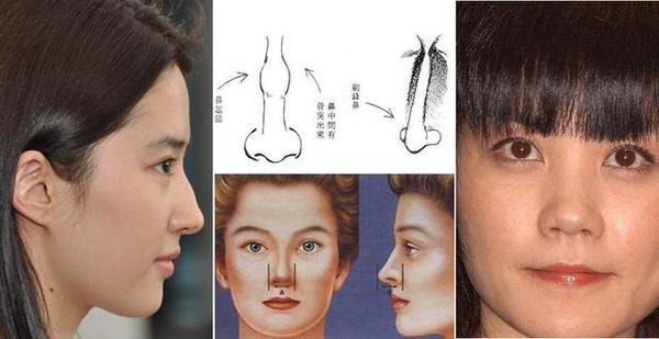 鼻子面相在女人命运当中代表「夫星」鼻子的形状与高低,色泽直接关联